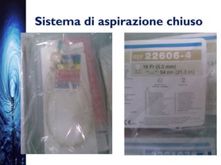 Sistema di aspirazione chiuso
 