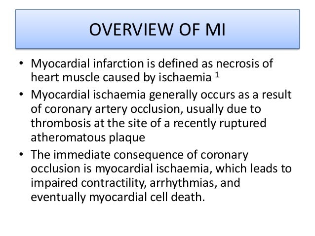 Aspirin In Myocardial Infarction By Pharm Jimmy Aiden