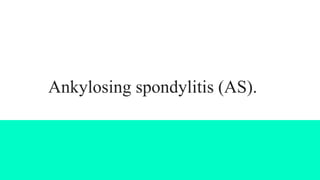 Ankylosing spondylitis (AS).
 