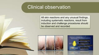 Clinical observation
All skin reactions and any unusual findings,
including systematic reactions, result from
induction and challenge procedures should
be observed and recorded
 