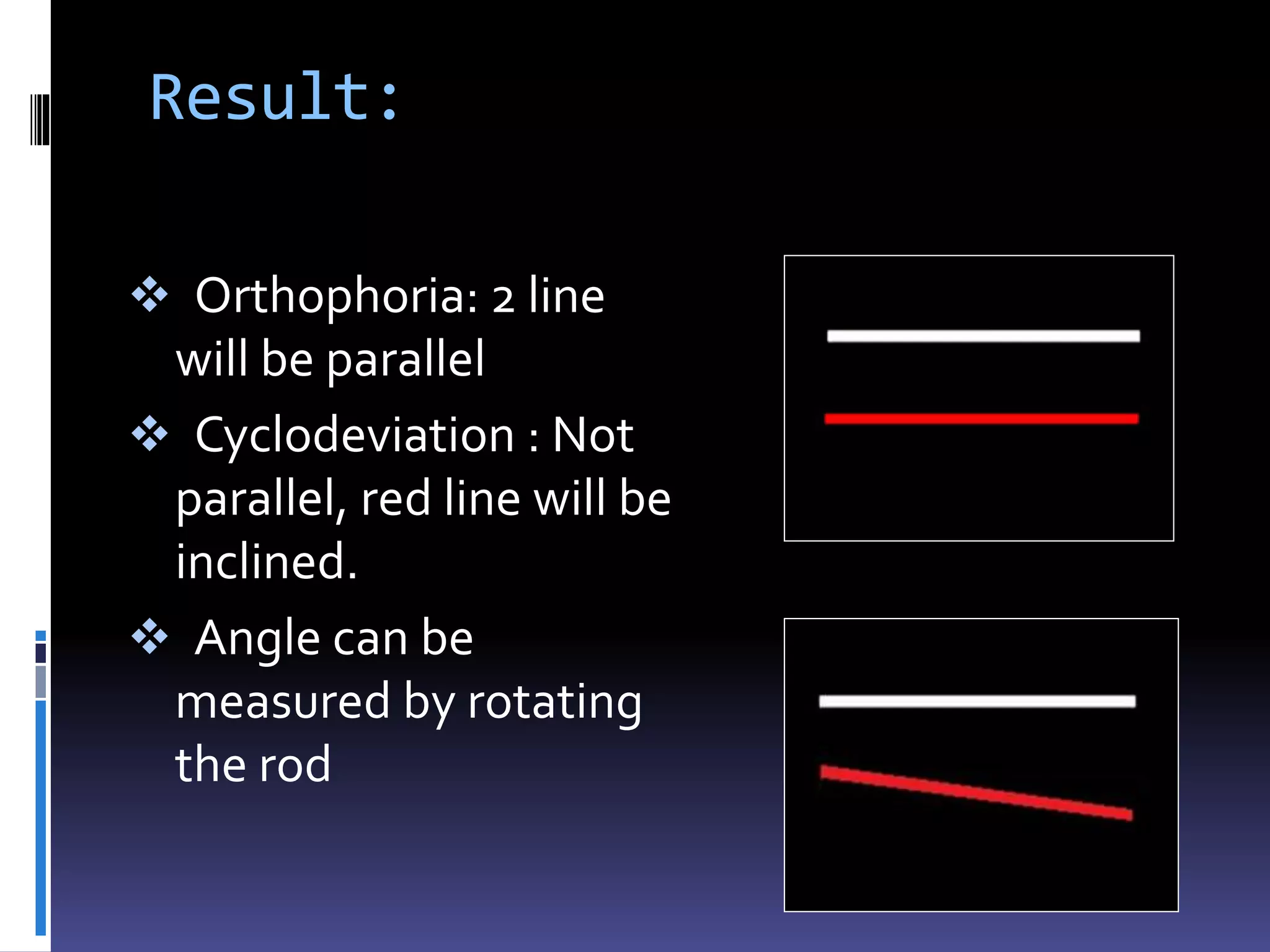 Result:
 Orthophoria: 2 line
will be parallel
 Cyclodeviation : Not
parallel, red line will be
inclined.
 Angle can be
measured by rotating
the rod
 