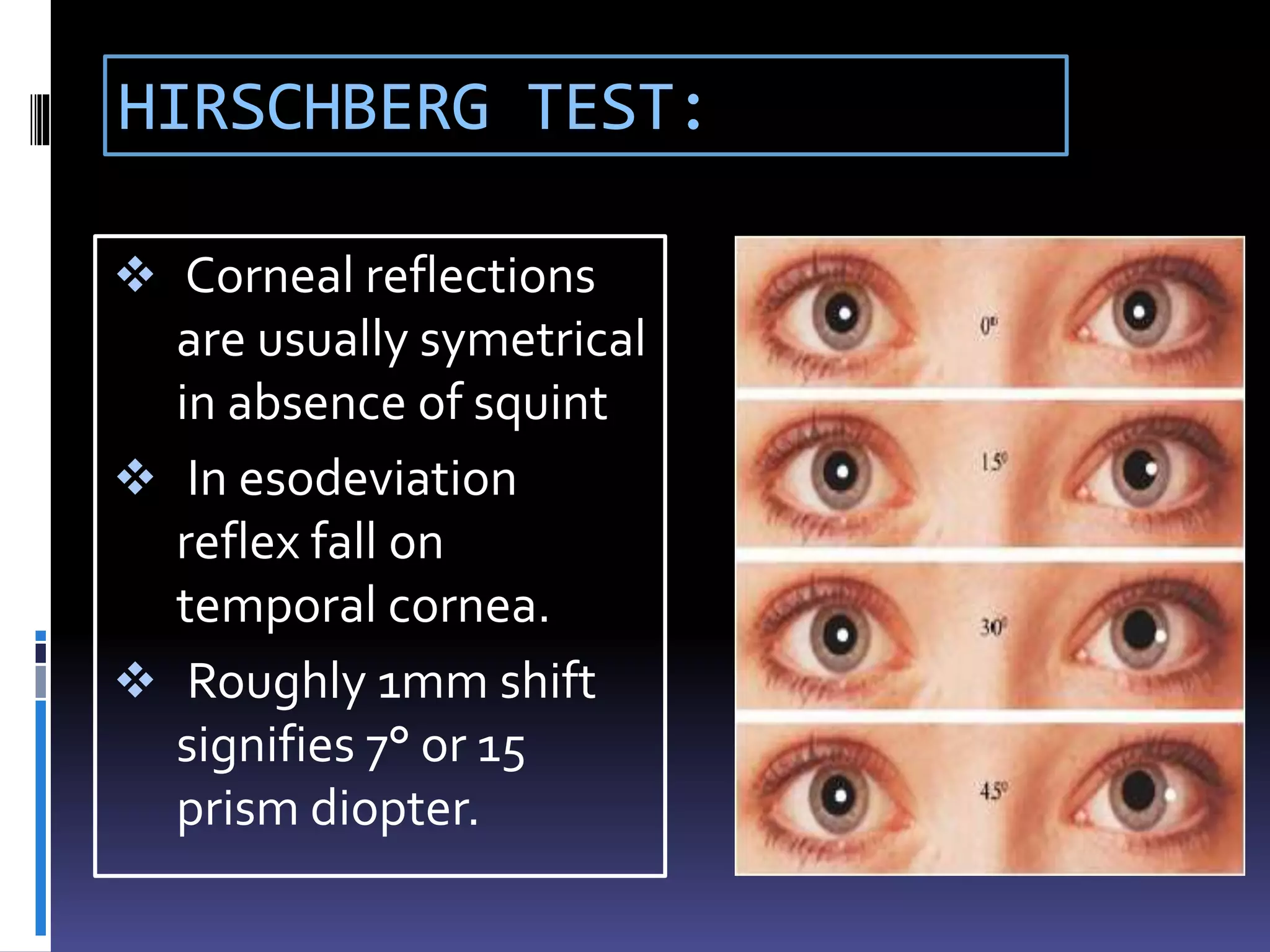 HIRSCHBERG TEST:
 Corneal reflections
are usually symetrical
in absence of squint
 In esodeviation
reflex fall on
temporal cornea.
 Roughly 1mm shift
signifies 7° or 15
prism diopter.
 
