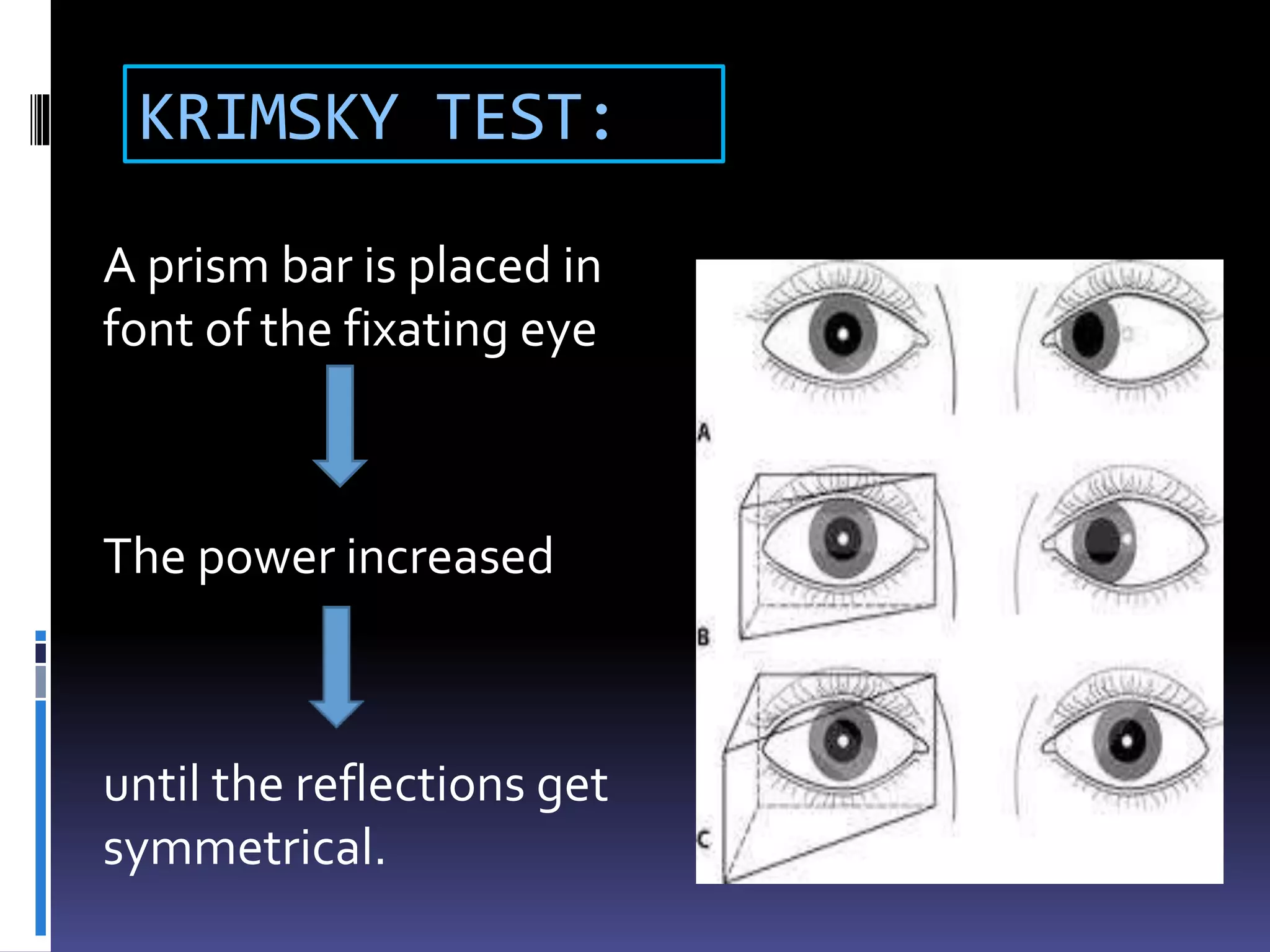 KRIMSKY TEST:
A prism bar is placed in
font of the fixating eye
The power increased
until the reflections get
symmetrical.
 