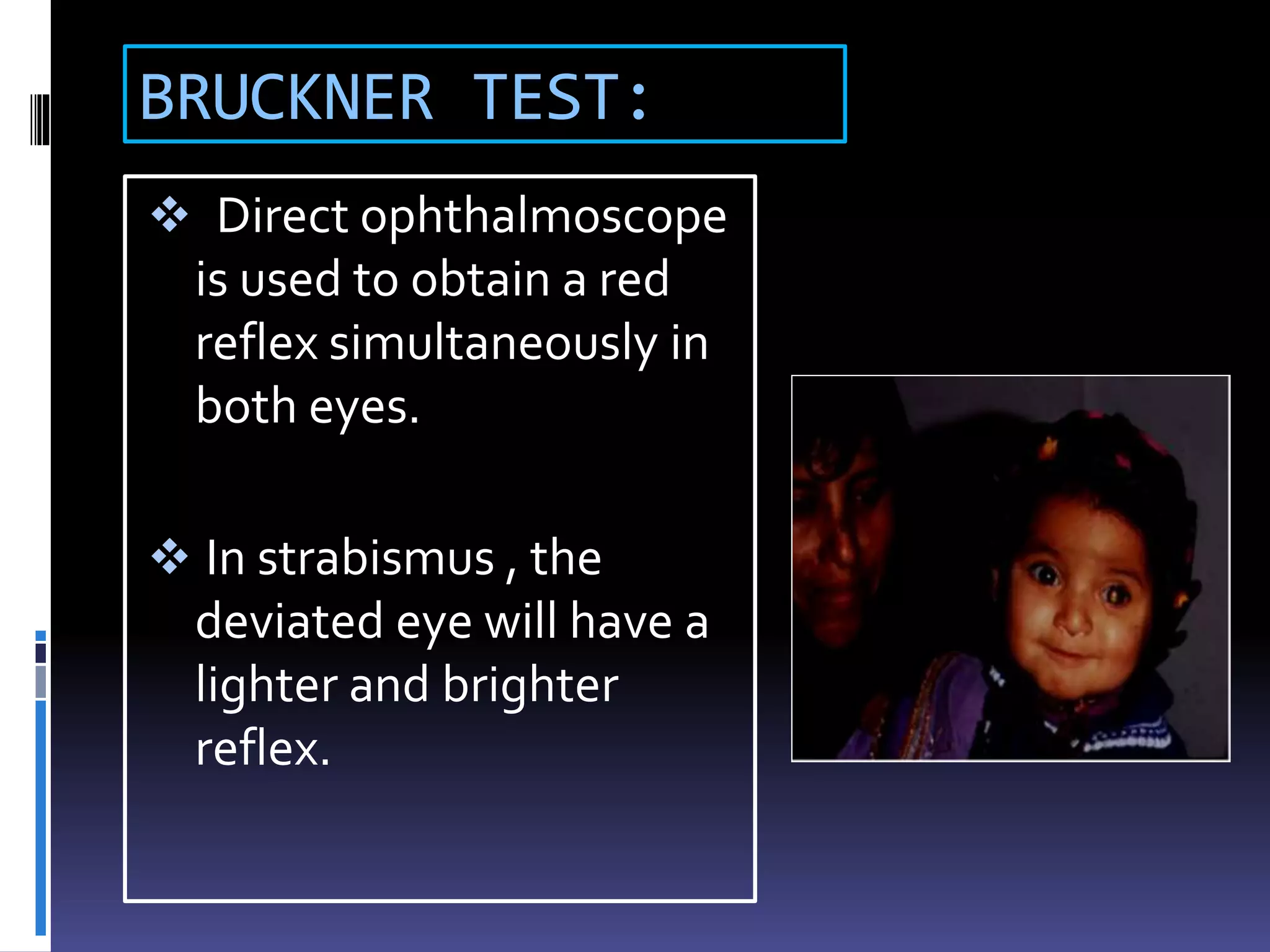 BRUCKNER TEST:
 Direct ophthalmoscope
is used to obtain a red
reflex simultaneously in
both eyes.
 In strabismus , the
deviated eye will have a
lighter and brighter
reflex.
 