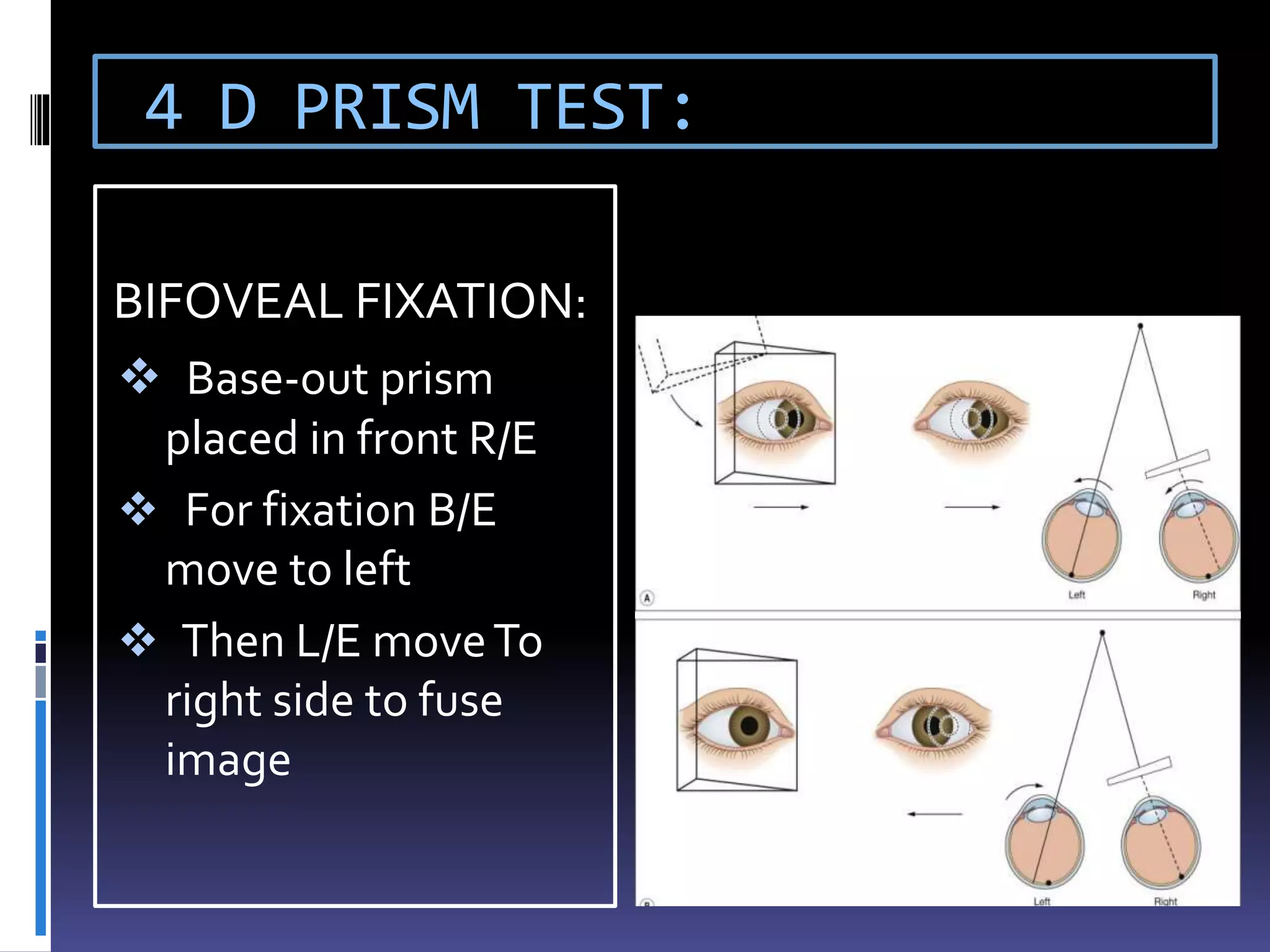4 D PRISM TEST:
BIFOVEAL FIXATION:
 Base-out prism
placed in front R/E
 For fixation B/E
move to left
 Then L/E moveTo
right side to fuse
image
 