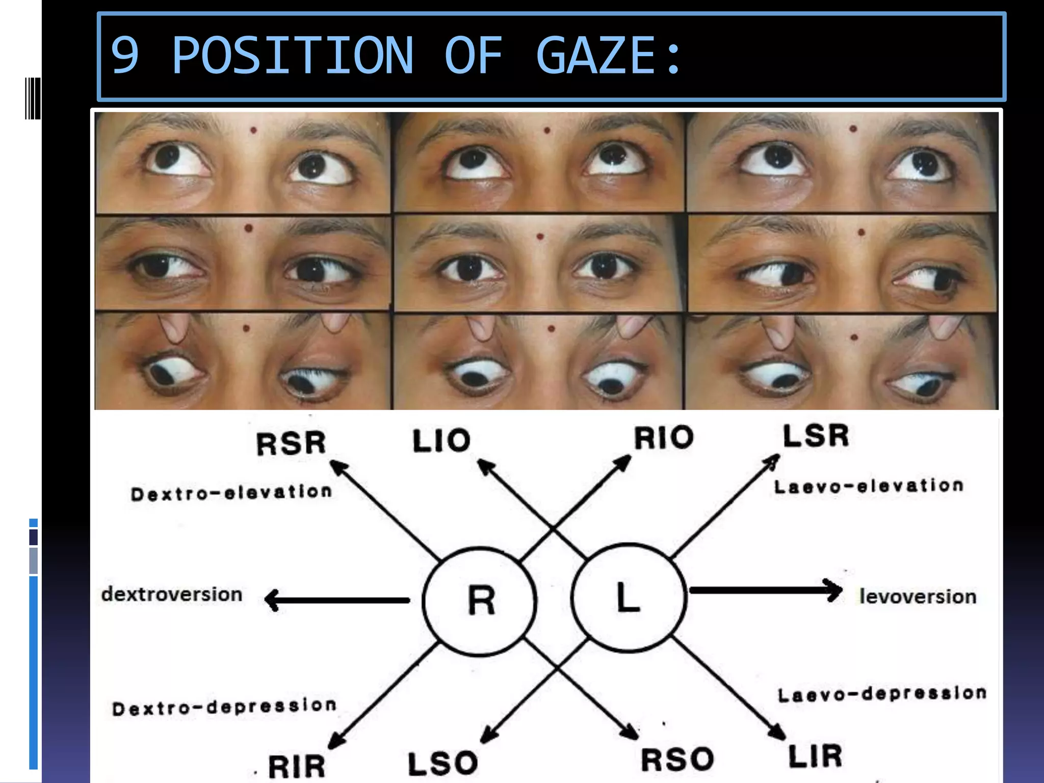 9 POSITION OF GAZE:
 