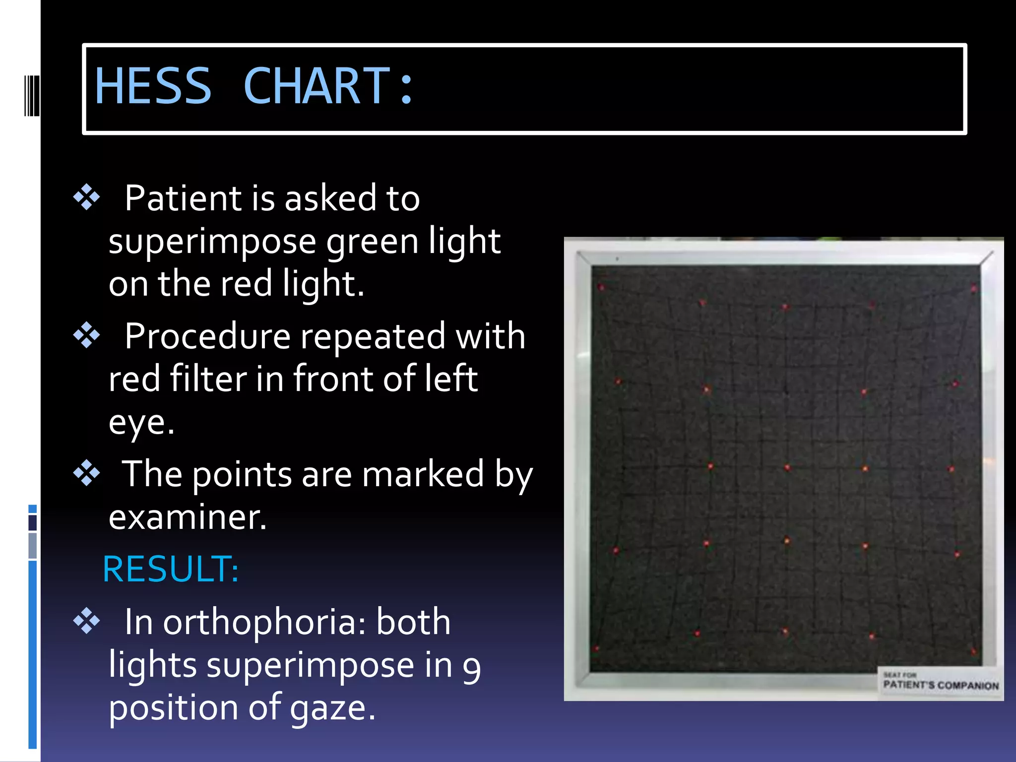 HESS CHART:
 Patient is asked to
superimpose green light
on the red light.
 Procedure repeated with
red filter in front of left
eye.
 The points are marked by
examiner.
RESULT:
 In orthophoria: both
lights superimpose in 9
position of gaze.
 