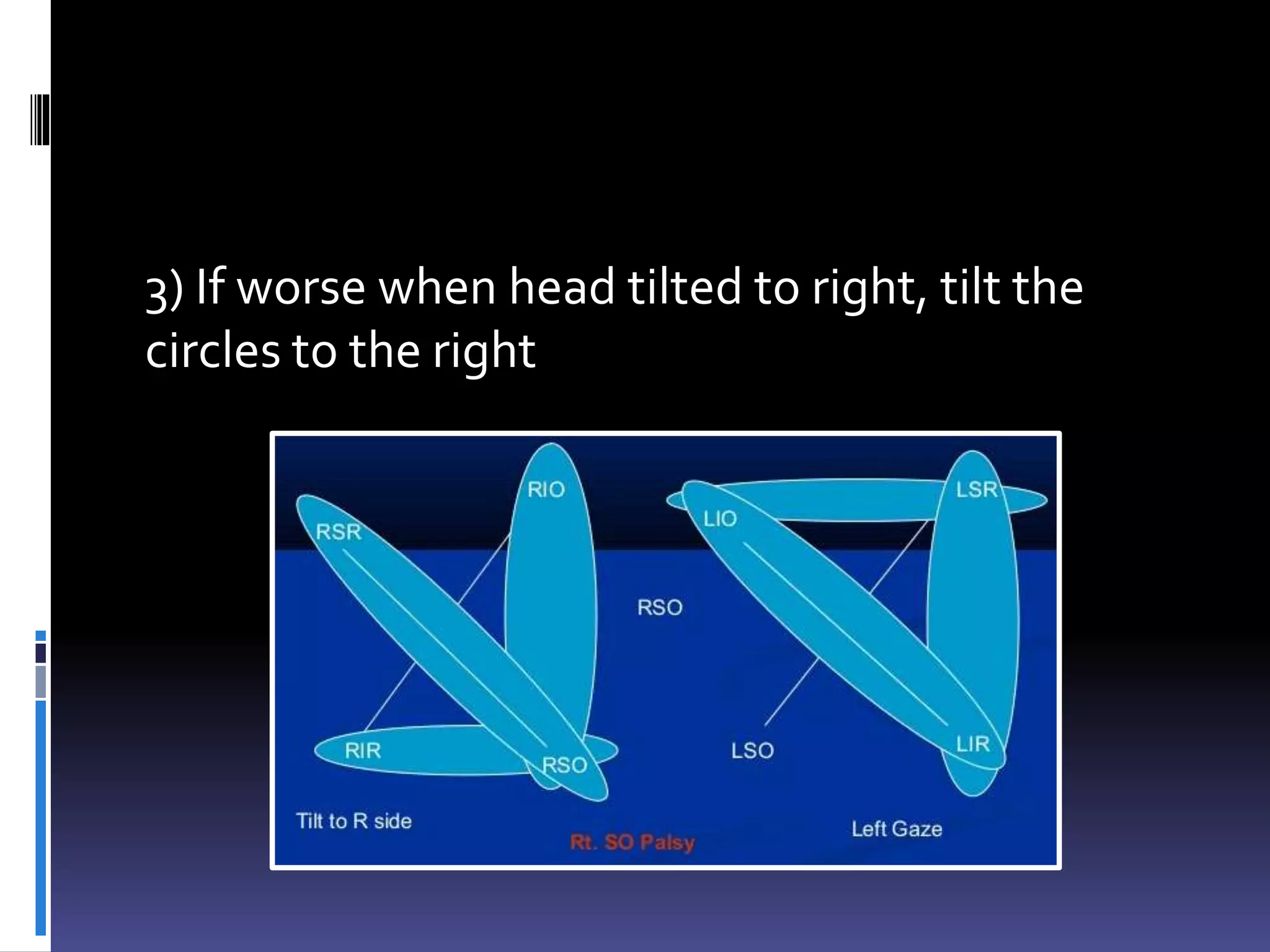 3) If worse when head tilted to right, tilt the
circles to the right
 