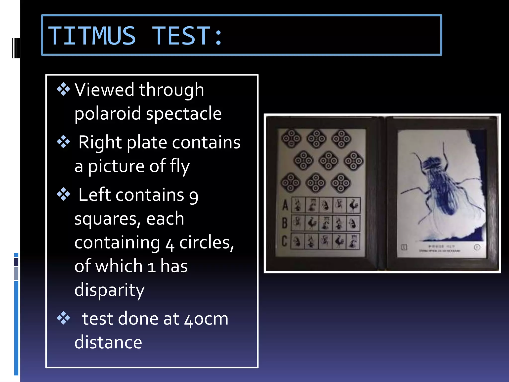 TITMUS TEST:
Viewed through
polaroid spectacle
 Right plate contains
a picture of fly
 Left contains 9
squares, each
containing 4 circles,
of which 1 has
disparity
 test done at 40cm
distance
 
