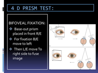 Assesssment of strabismus | PPTX