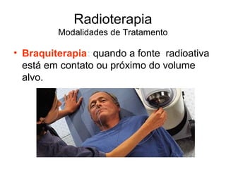 Radioterapia
Modalidades de Tratamento
• Braquiterapia: quando a fonte radioativa
está em contato ou próximo do volume
alvo.
 