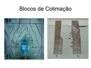 Blocos de Colimação
 