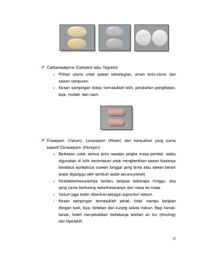 Epilepsi (sawan)