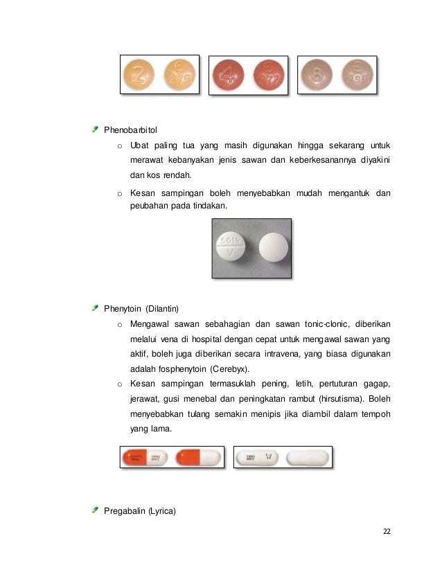 Epilepsi (sawan)