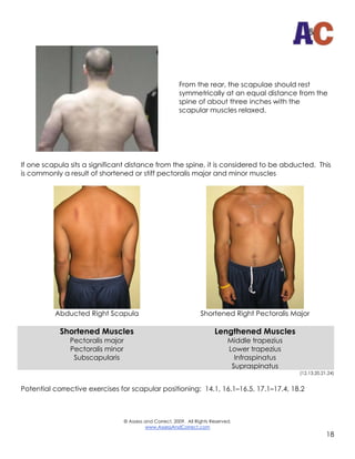 © Assess and Correct, 2009. All Rights Reserved.
www.AssessAndCorrect.com
19
THORACIC SPINE (UPPER BACK) POSTURE
In the si...