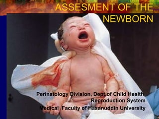 ASSESMENT OF THE
NEWBORN
Perinatology Division, Dept of Child Health,
Reproduction System
Medical Faculty of Hasanuddin University
 