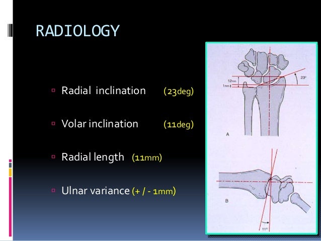 Assessent and radiology of distal end radius fracture