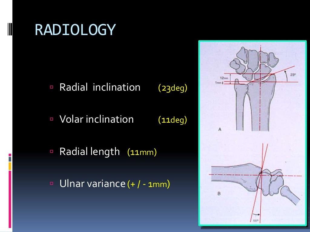 Assessent and radiology of distal end radius fracture