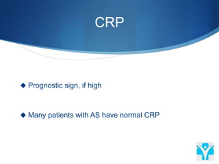 CRP
 Prognostic sign, if high
 Many patients with AS have normal CRP
 