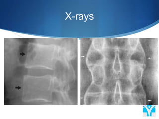 X-rays
 