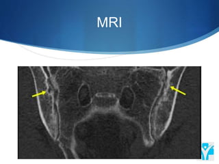 MRI
 