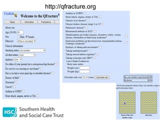 Fracture Risk Questionnaire Assessing Fracture Risk | PPT
