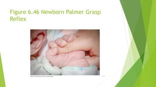 Assessing Reflexes of children in paediatrics pptx | PPTX