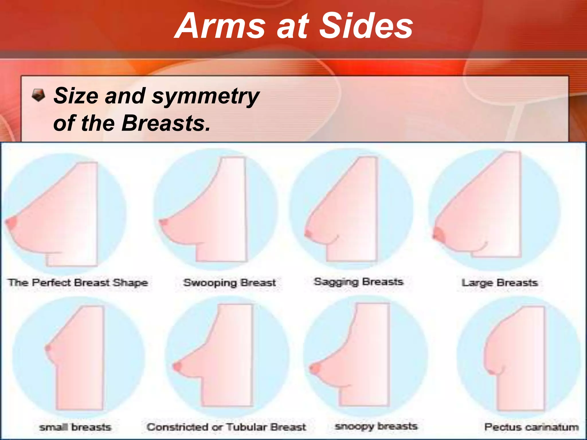 Arms at Sides