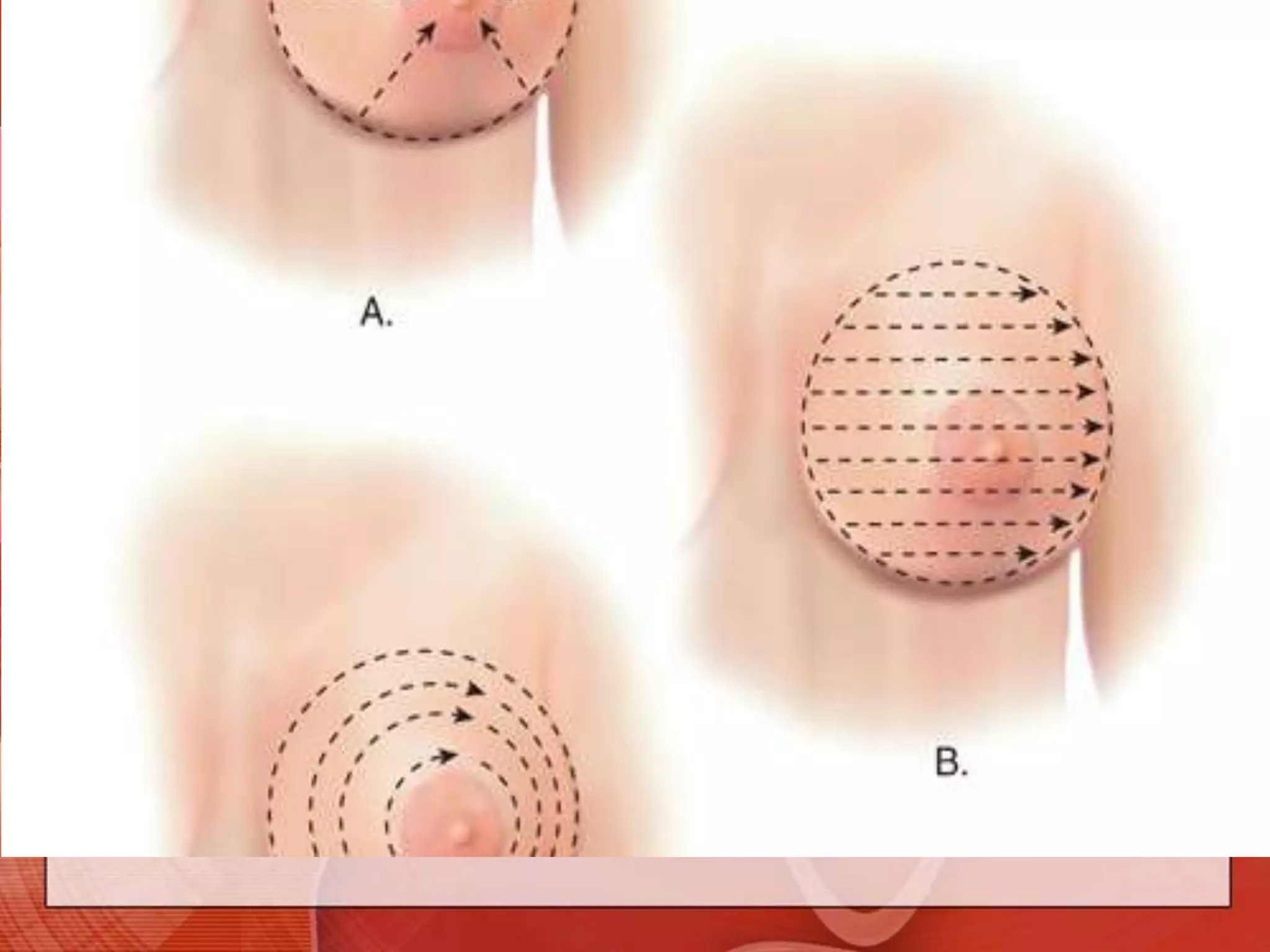 To examine the lateral portion of the breastAsk the patient to roll onto the opposite hip, placing her hand on her forehead but keeping the shoulders pressed against the bed or examining table.	