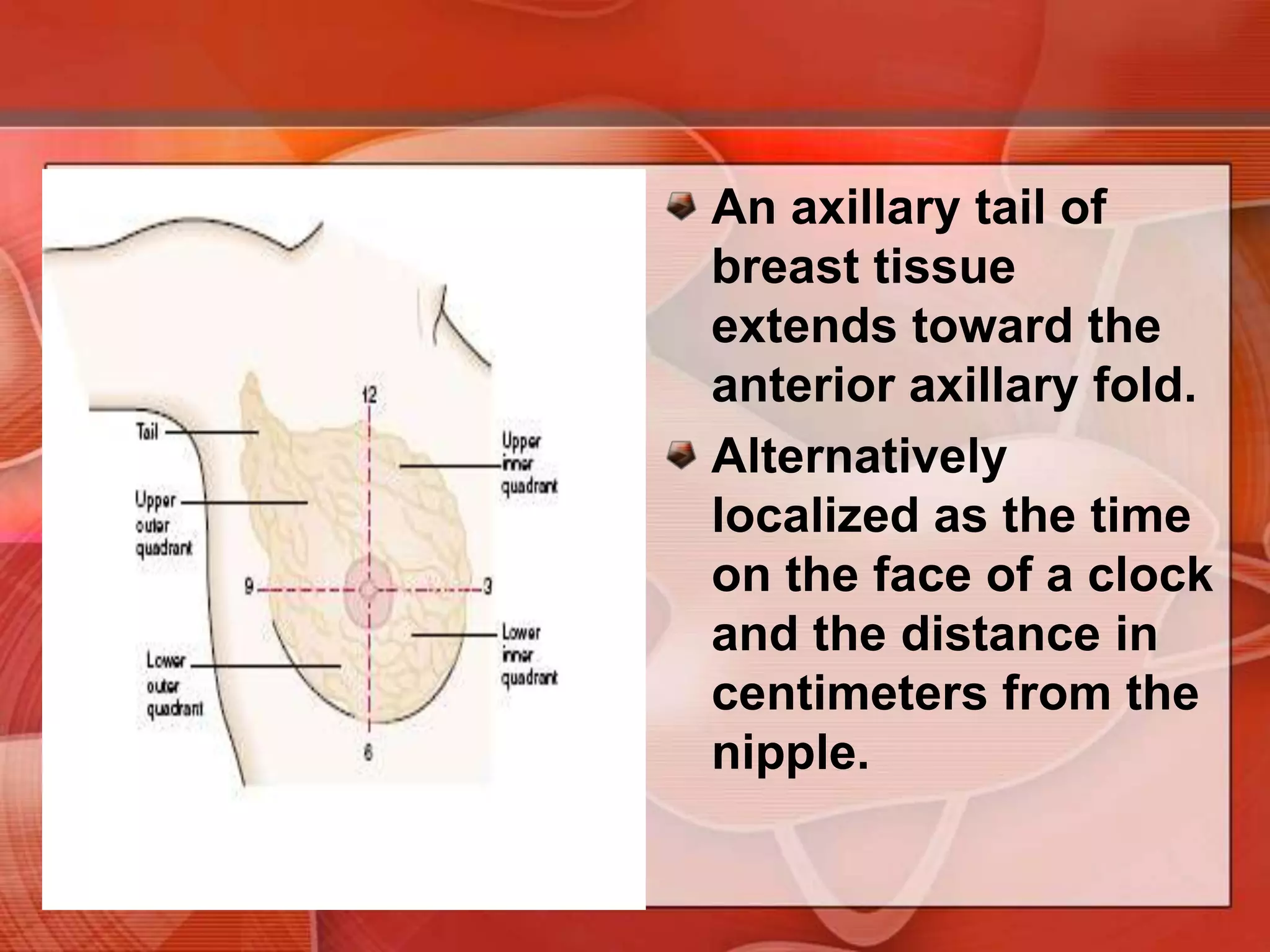 Describe clinical findings, the breast is often divided into four quadrants based on horizontal and vertical lines crossing at the nipple. 