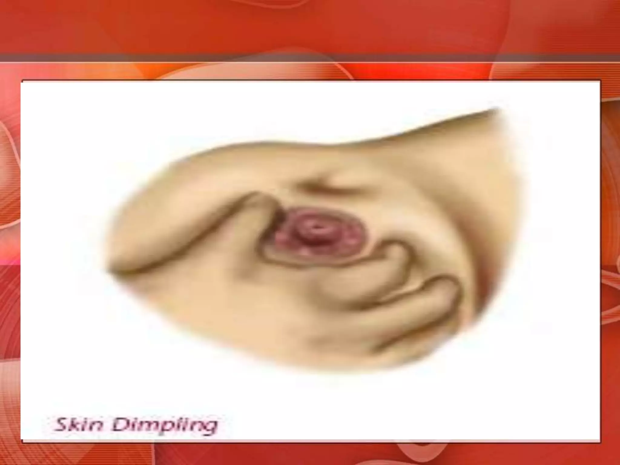 Visible Signs of Cancer