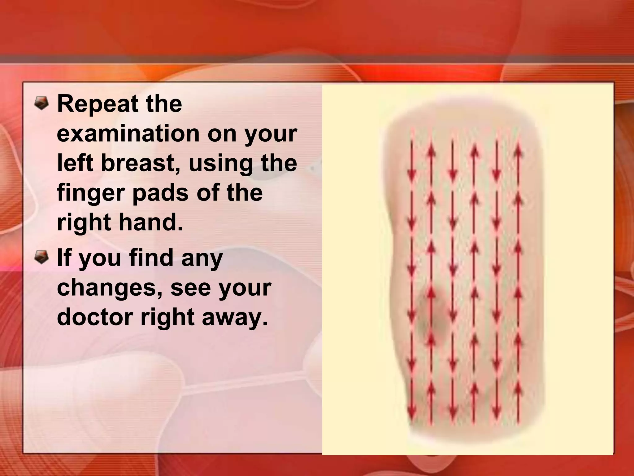 Press firmly on the breast in an up-and-down or “strip” pattern.You can also use a circular or wedge pattern, but be sure to use the same pattern every time.Check the entire breast area, and remember how your breast feels from month to month.