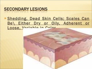 Shedding, Dead Skin Cells; Scales Can Be\ Either Dry or Oily, Adherent or Loose, Variable in Color 