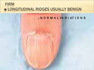 /  N O R M A L VA R I AT I O N S 