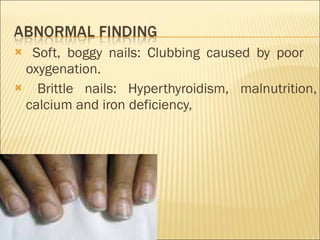 Soft, boggy nails: Clubbing caused by poor  oxygenation. Brittle nails: Hyperthyroidism, malnutrition, calcium and iron deficiency,  