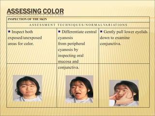 INSPECTION OF THE SKIN A S S E S S M E N T  T E C H N I Q U E S / N O R M A L VA R I AT I O N S ■ Inspect both exposed/unexposed areas for color. ■ Differentiate central cyanosis from peripheral cyanosis by inspecting oral mucosa and conjunctiva. ■ Gently pull lower eyelids down to examine conjunctiva. 