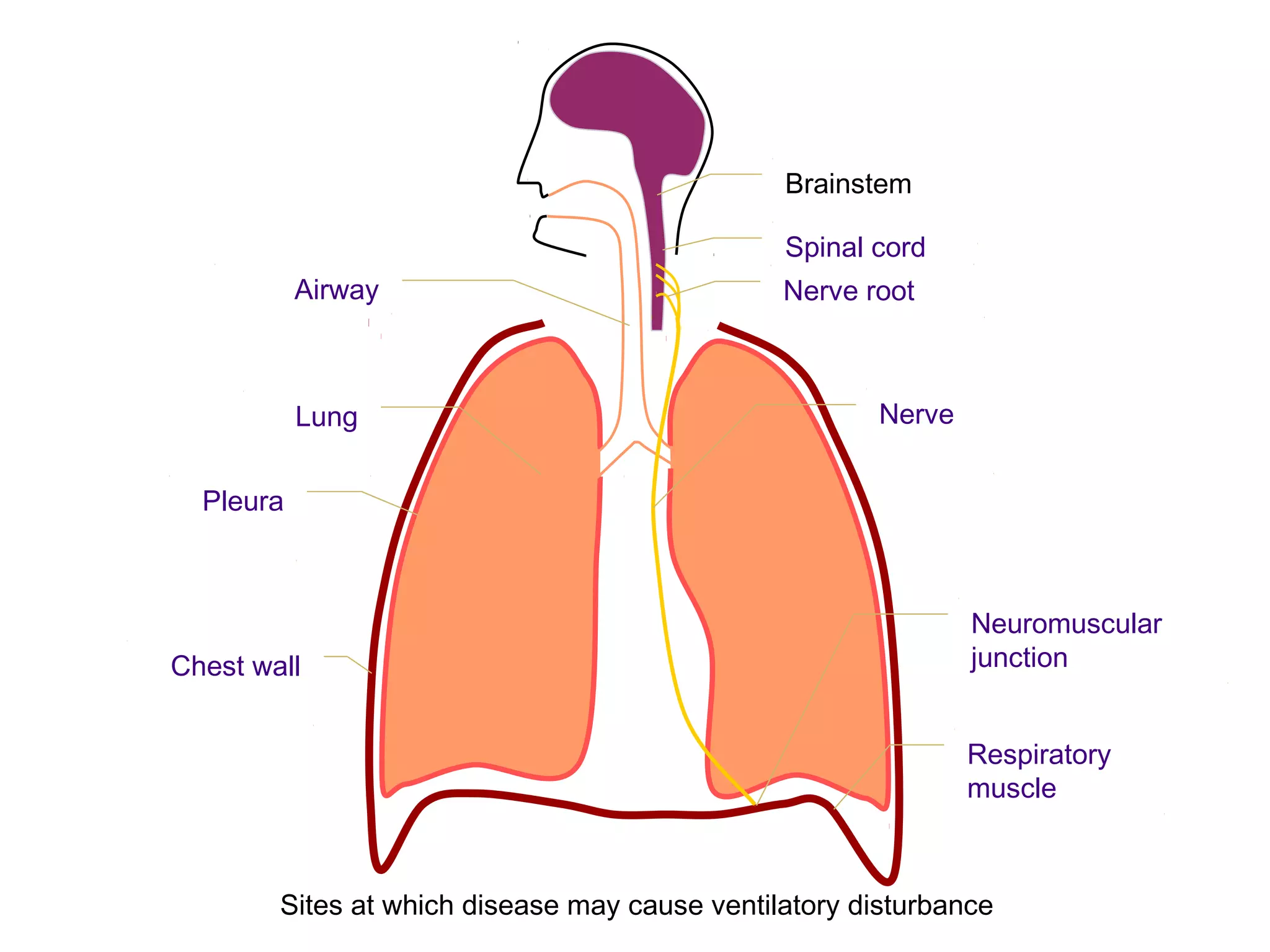 Brainstem
Spinal cord
Nerve rootAirway
Nerve
Neuromuscular
junction
Respiratory
muscle
Lung
Pleura
Chest wall
Sites at which disease may cause ventilatory disturbance
 
