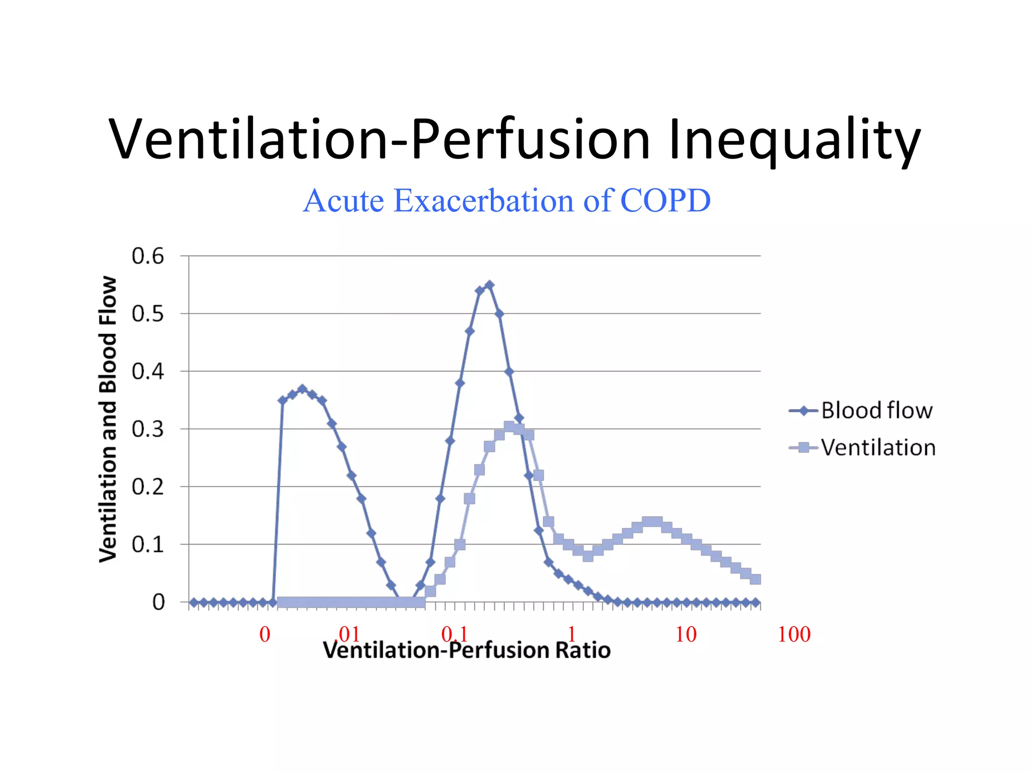 Ventilation-Perfusion Inequality
Acute Exacerbation of COPD
0 .01 0.1 1 10 100
 