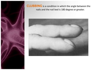 Nail Clubbing Algorithm Assessing the skin | PPTX