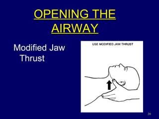 OPENING THE AIRWAY Modified Jaw Thrust 