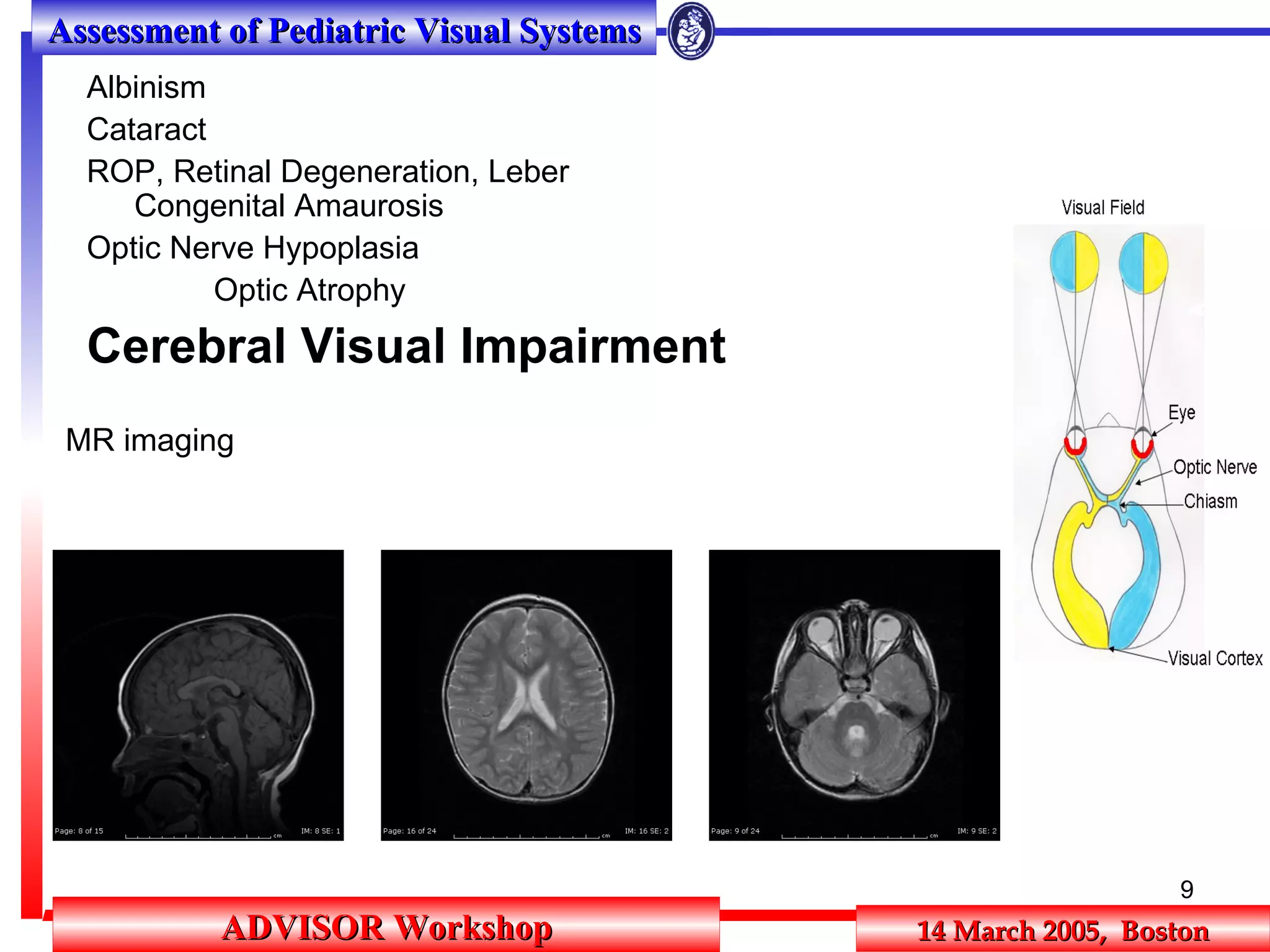 Assessment of the Pediatric Visual System | PPT