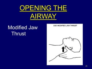 20
OPENING THE
AIRWAY
Modified Jaw
Thrust
 