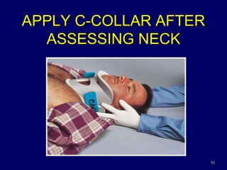 51
APPLY C-COLLAR AFTER
ASSESSING NECK
 