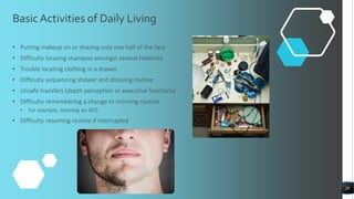 BasicActivities of Daily Living
• Putting makeup on or shaving only one half of the face
• Difficulty locating shampoo amongst several toiletries
• Trouble locating clothing in a drawer
• Difficulty sequencing shower and dressing routine
• Unsafe transfers (depth perception or executive functions)
• Difficulty remembering a change to morning routine
• For example, donning an AFO
• Difficulty resuming routine if interrupted
28
 