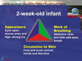 Assessment And Managment Of Critically Ill Child 1 | PPT