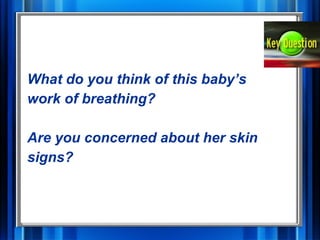 Assessment And Managment Of Critically Ill Child 1 | PPT