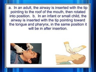 Assessment And Managment Of Critically Ill Child 1 | PPT
