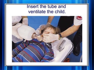 Assessment And Managment Of Critically Ill Child 1 | PPT