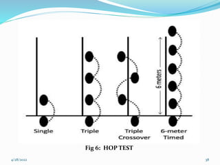 Hop Test Pass Assessment and Needs Analysis..pptx