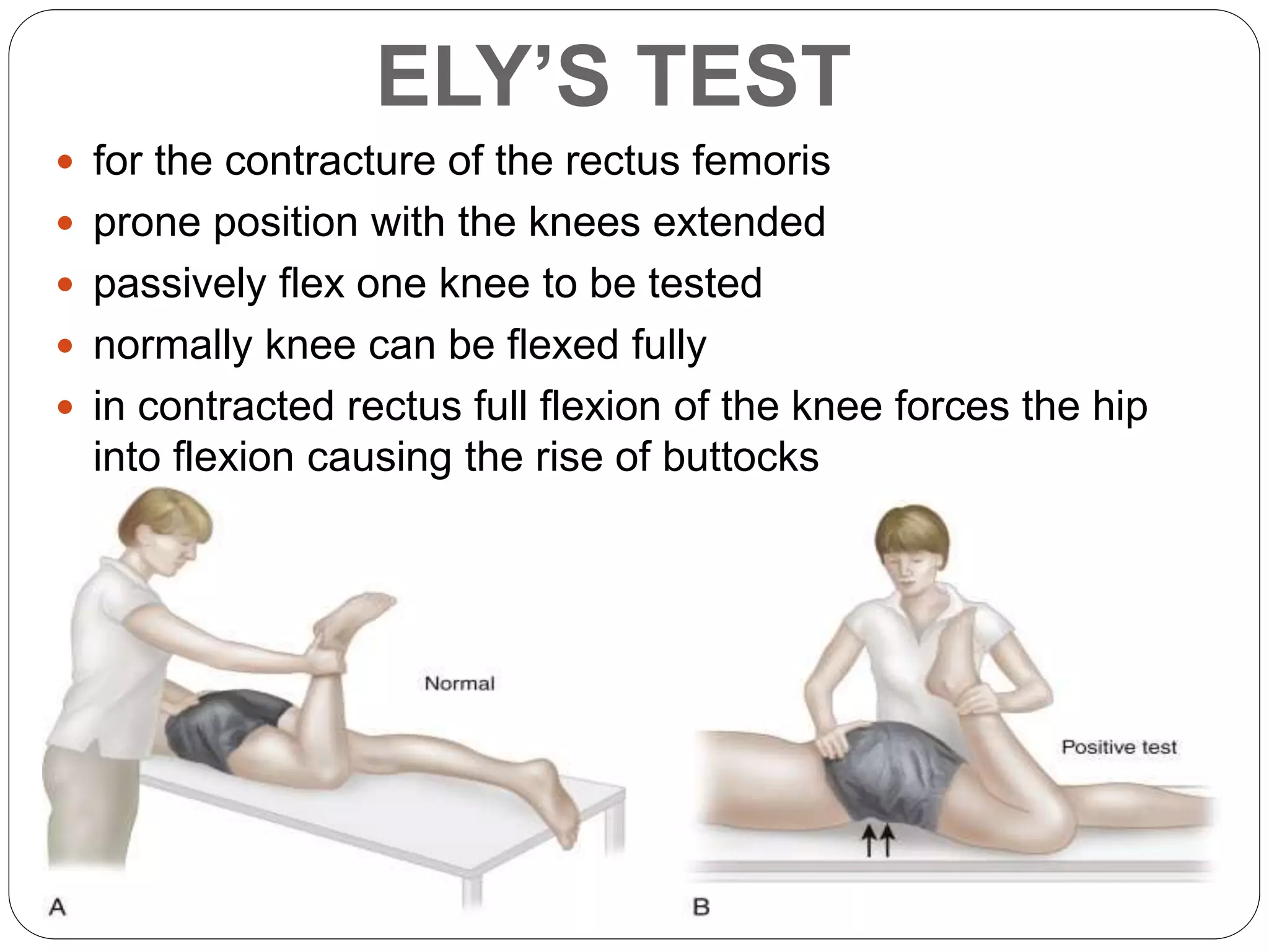Eli Test Assessment and special tests of Hip joint | PPTX